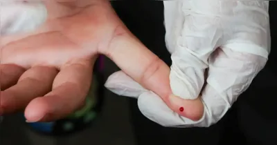 O exame incorporado é o teste de antígeno NS1, utilizado para detectar uma proteína do vírus presente no sangue logo no início da infecção.