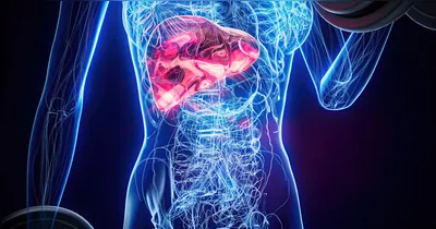 O câncer de pâncreas surge quando células da glândula pancreática passam a se multiplicar de forma descontrolada