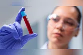 O Galleri é um teste de rastreio multicâncer, termo preferido pelos oncologistas ao invés de biópsia líquida, embora os dois signifiquem a mesma coisa.