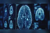 Estudo reforça que o desenvolvimento da doença não depende apenas da genética.