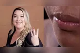 A agressora foi presa no estado do Piauí, após fugir