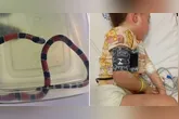 Criança ficou estado grave devido a picada da cobra