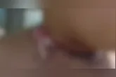 A criança sofreu um grave ferimento no pescoço após a descarga