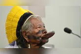 A condição pré-existente decorrente de um acidente que sofreu há mais de 20 anos.
