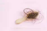 A alopecia fibrosante frontal é uma das doenças que tem ligaçãoi direta com o uso de anticoncepcionais.