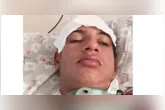 Família busca apoio para que jovem passe por procedimento especializado e possa recuperar a respiração pelo nariz.