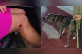 A vítima chegou a ser atacada na perna, mas foi salva pelos policiais