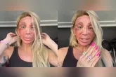 Maya Massafera surpreendeu os seguidores após surgir com o rosto completamente avermelhado depois do processo de recuperação do Laser de CO2.
