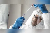 O Ebola é uma doença viral grave que provoca febre hemorrágica e apresenta alta taxa de mortalidade.
