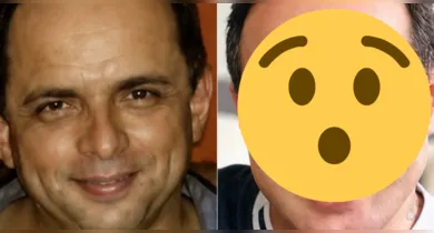 Imagem ilustrativa da notícia: Marido de Gretchen mostra antes e depois das plásticas; confira!