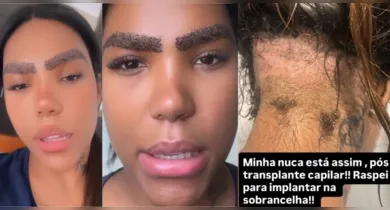 Imagem ilustrativa da notícia: Carol Lekker raspa cabelo para transplante de sobrancelha; veja