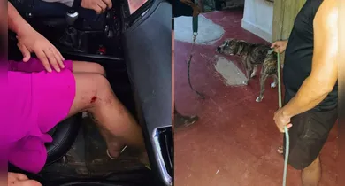 Imagem ilustrativa da notícia: Policiais militares salvam família de ataque de pitbull no Pará