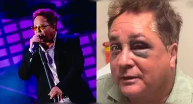 Imagem ilustrativa da notícia: Leonardo esconde olho roxo com óculos escuros após acidente