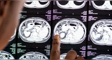 Imagem ilustrativa da notícia: Dormir muitas horas pode aumentar risco de demência, diz estudo