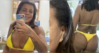 Imagem ilustrativa da notícia: Tati Quebra Barraco posa de biquini após harmonização nos glúteos