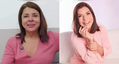 Imagem ilustrativa da notícia: "Autoestima renovada", diz Mara Maravilha após facelifting