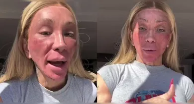 Imagem ilustrativa da notícia: Maya Massafera mostra efeito de peeling no rosto e choca web