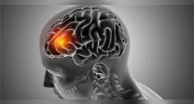 Imagem ilustrativa da notícia: Esclerose múltipla: sintomas, como diagnosticar e tratamento