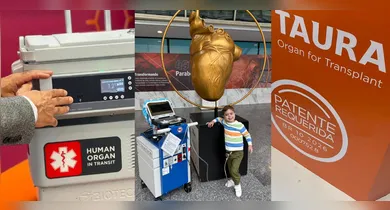 Imagem ilustrativa da notícia: Taura: tecnologia brasileira pode mudar o tempo dos transplantes no Brasil