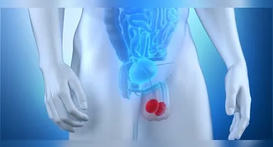 Imagem ilustrativa da notícia: Câncer de testículo: o que é a doença e quais os fatores de risco