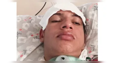 Família busca apoio para que jovem passe por procedimento especializado e possa recuperar a respiração pelo nariz.