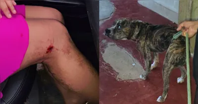 A vítima chegou a ser atacada na perna, mas foi salva pelos policiais