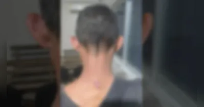 Homem sofreu ferimento na cabeça e nuca devido o golpe recebido com a pá