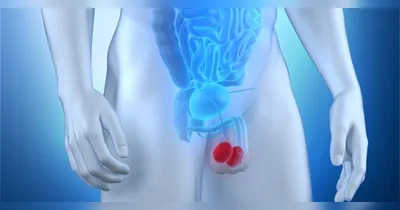 Conscientize-se sobre o câncer de testículo
