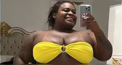 Imagem ilustrativa da notícia: Jojo Todynho faz lipo de definição nas pernas após perder cerca de 90 kg