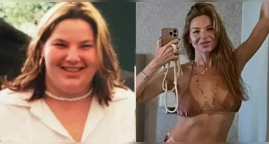 Imagem ilustrativa da notícia: Repórter da globo perdeu 8 dentes e 70kg após bariátrica