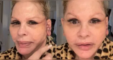 Imagem ilustrativa da notícia: Monique Evans tem problema com banco após cirurgia facial
