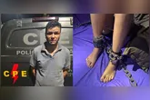 Ela mostrou as marcas das agressões e afirmou que ainda sente os efeitos dos ataques.