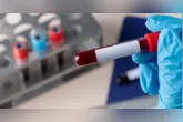 Exame de sangue Galleri chega ao Brasil com a proposta de detectar sinais de mais de 50 tipos de câncer antes do aparecimento de sintomas.