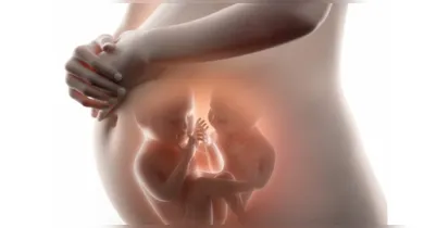 Imagem ilustrativa da notícia: Superfetação: entenda como uma mulher pode engravidar mesmo já estando grávida