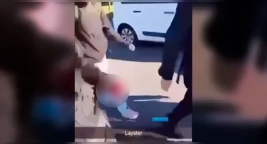 Imagem ilustrativa da notícia: Explosão durante protesto deixa jovem sem a mão na França