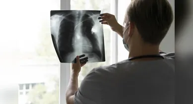 Imagem ilustrativa da notícia: Anvisa aprova novo medicamento para tratamento de câncer de pulmão avançado