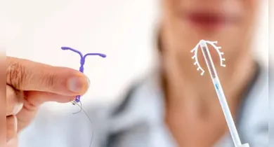 Imagem ilustrativa da notícia: Planos terão de cobrir DIU para casos de endometriose
