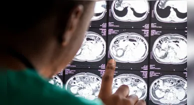 Imagem ilustrativa da notícia: Pesquisa aponta novo caminho para tratar inflamação no Alzheimer