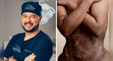 Imagem ilustrativa da notícia: Médico é condenado após cirurgia estética "X-Tudo" em SC
