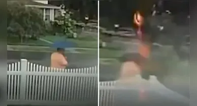 Imagem ilustrativa da notícia: Homem é atingido por raio a caminho do dentista, cai e levanta pedindo socorro