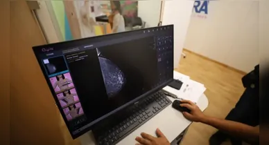 Imagem ilustrativa da notícia: Pará realiza mais de 9 mil mamografias em carretas da saúde