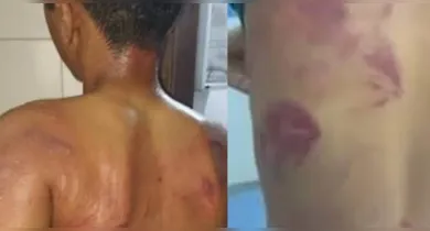 Imagem ilustrativa da notícia: Pai é preso após espancar filho de 13 anos por usar brincos em Pernambuco