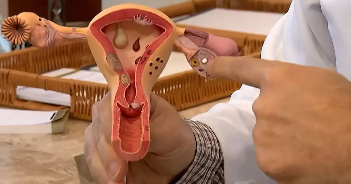 Menopausa precoce: causas, diagnóstico e impactos