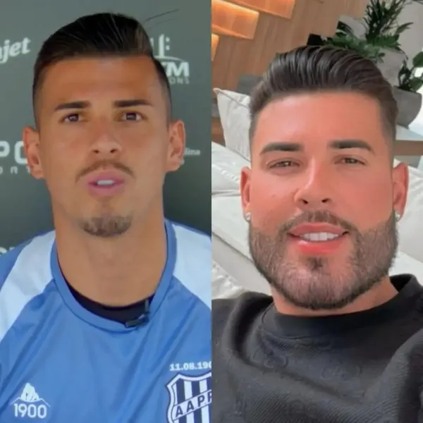 Goleiro do Remo já fez harmonização facial; veja outros jogadores que mudaram a aparência
