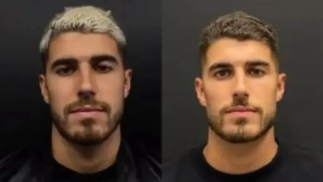 Goleiro do Remo já fez harmonização facial; veja outros jogadores que mudaram a aparência