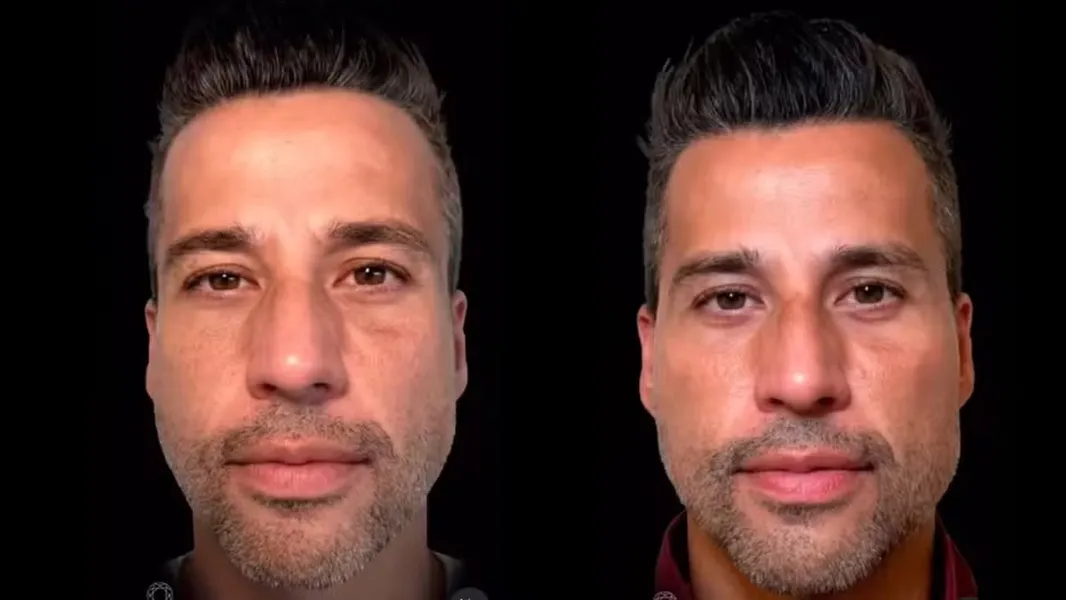 Goleiro do Remo já fez harmonização facial; veja outros jogadores que mudaram a aparência