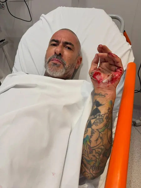 Henrique Fogaça diz que teve aliança roubada durante internação após acidente