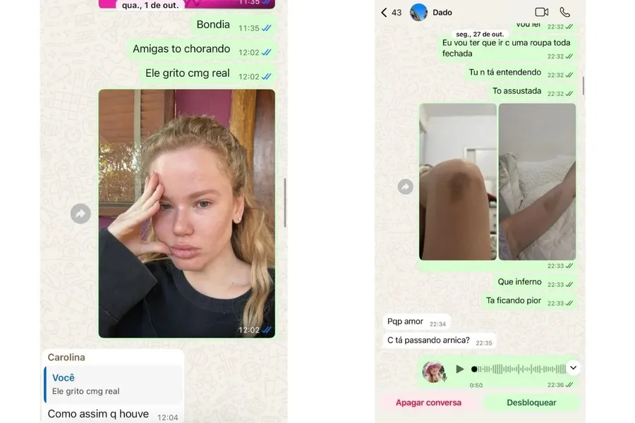Veja prints em que Marcela expõe machucados e conversas com Dado