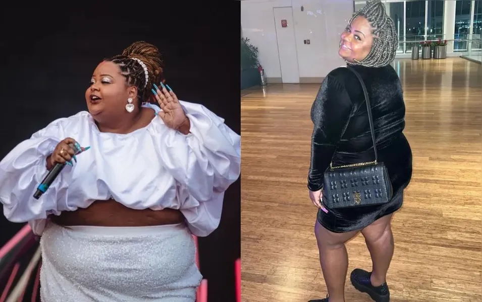 MC Carol gasta R$ 100 mil em cirurgias plásticas. Veja resultado!