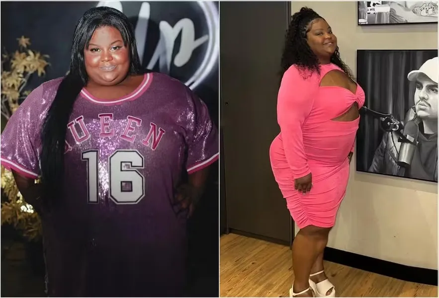 MC Carol gasta R$ 100 mil em cirurgias plásticas. Veja resultado!